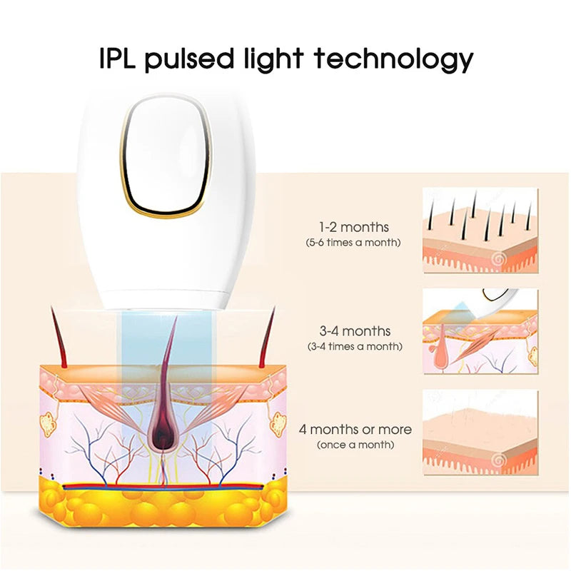 Hair Removal Laser Epilator
